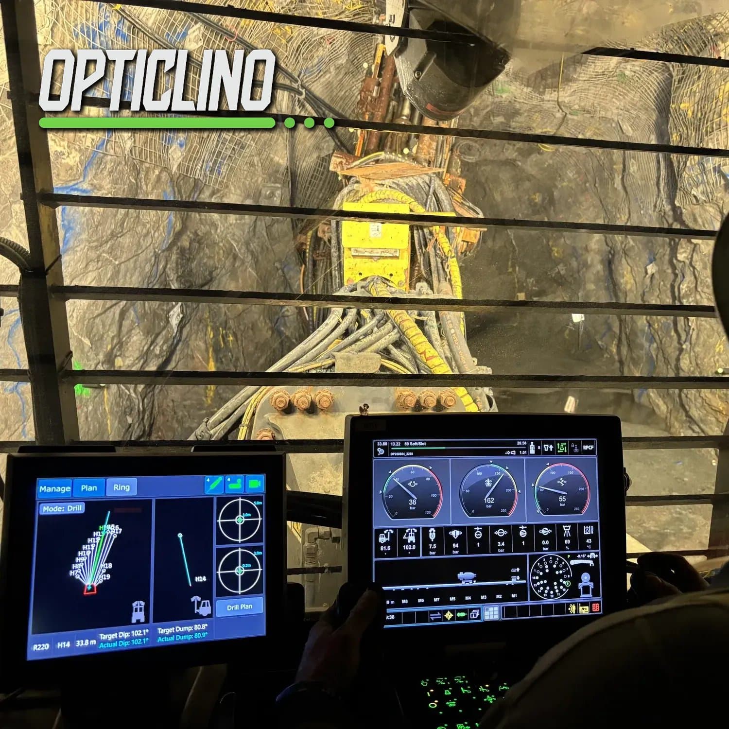 OptiClino
